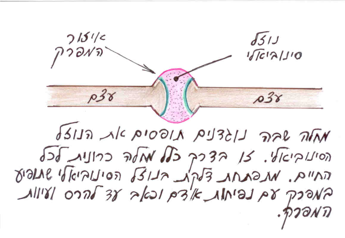 דלקת מפרקים ראומטית